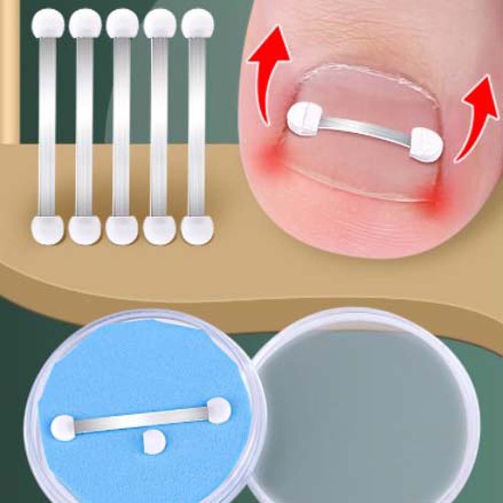 Toenail Correction Pedicure Tool