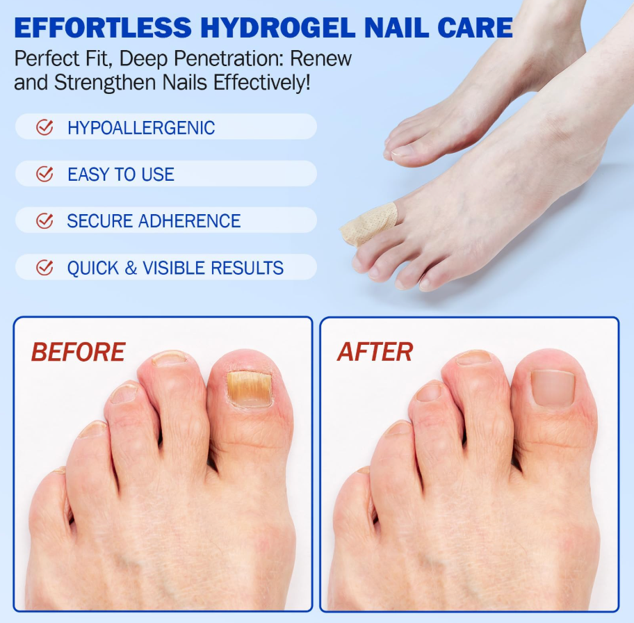Fungus Nail Patches