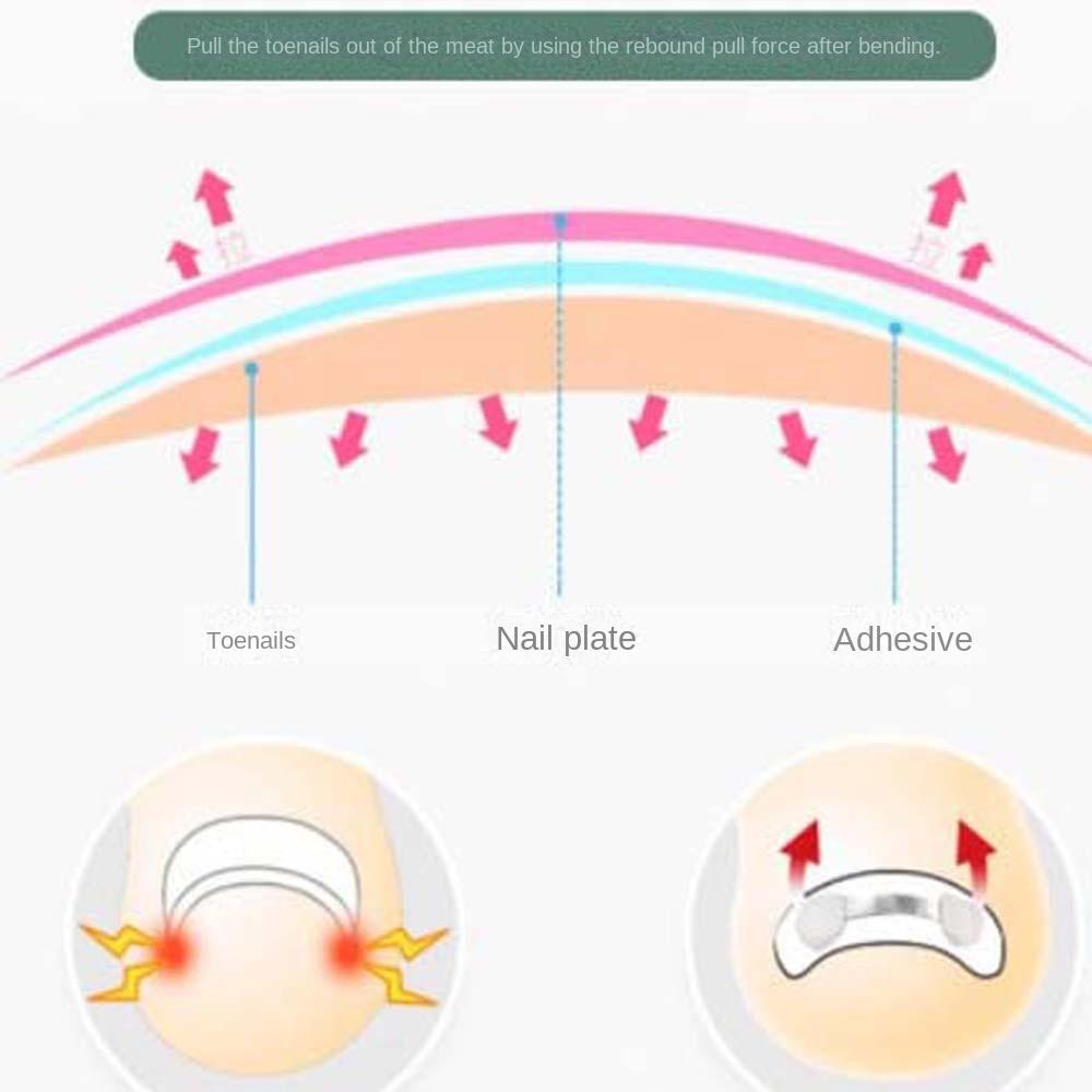 Toenail Correction Pedicure Tool