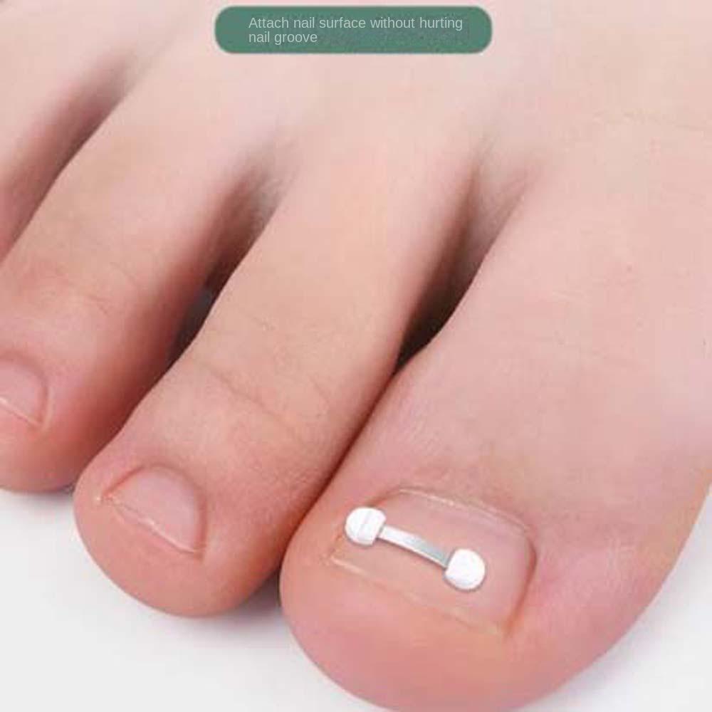 Toenail Correction Pedicure Tool