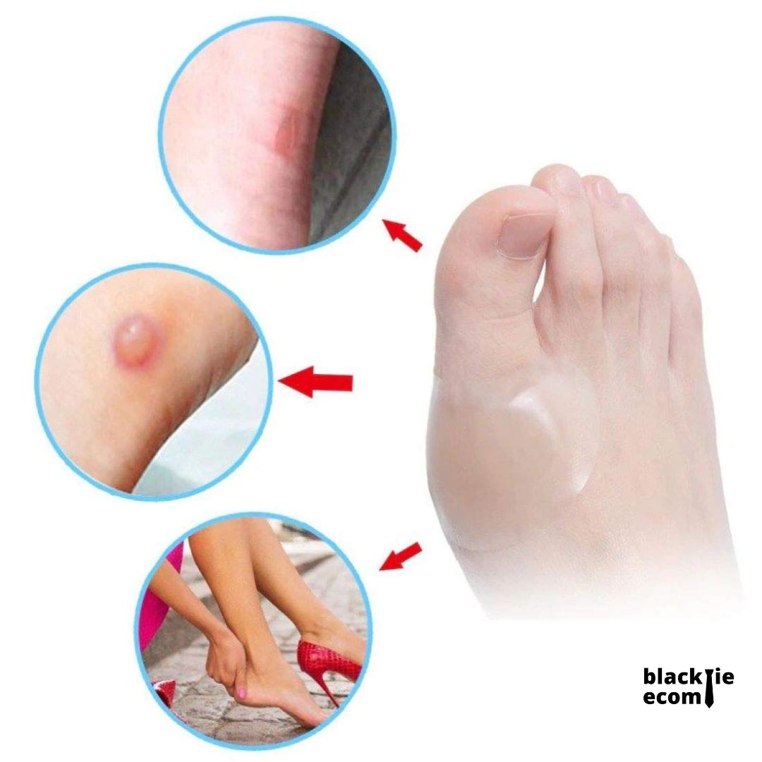 Hydrocolloid Blister Plaster Bandage